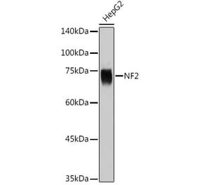 Western Blot - Anti-NF2 / Merlin Antibody (A91286) - Antibodies.com