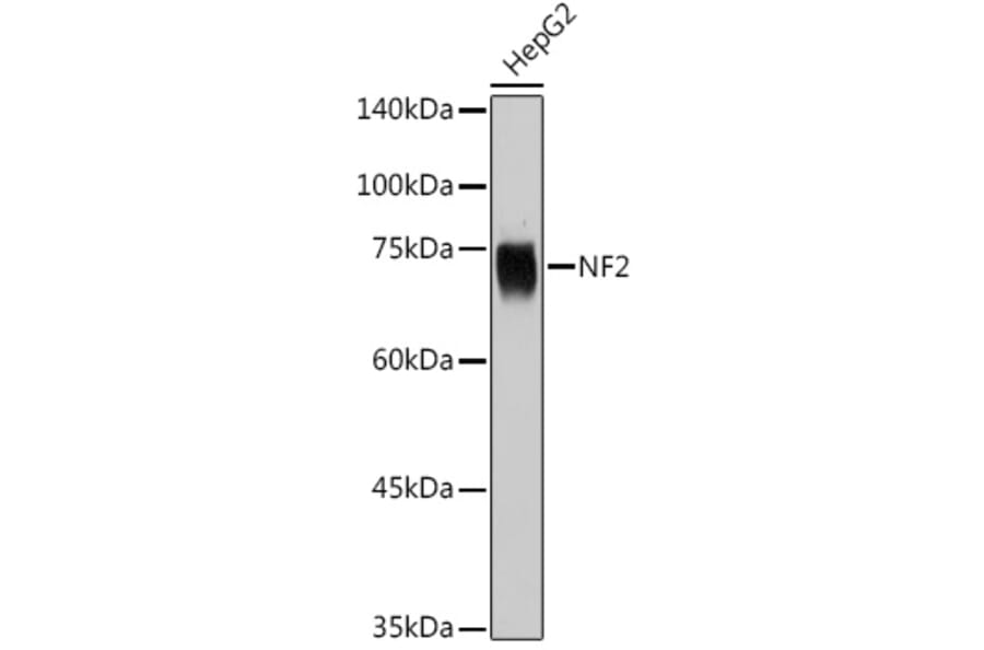 Western Blot - Anti-NF2 / Merlin Antibody (A91286) - Antibodies.com