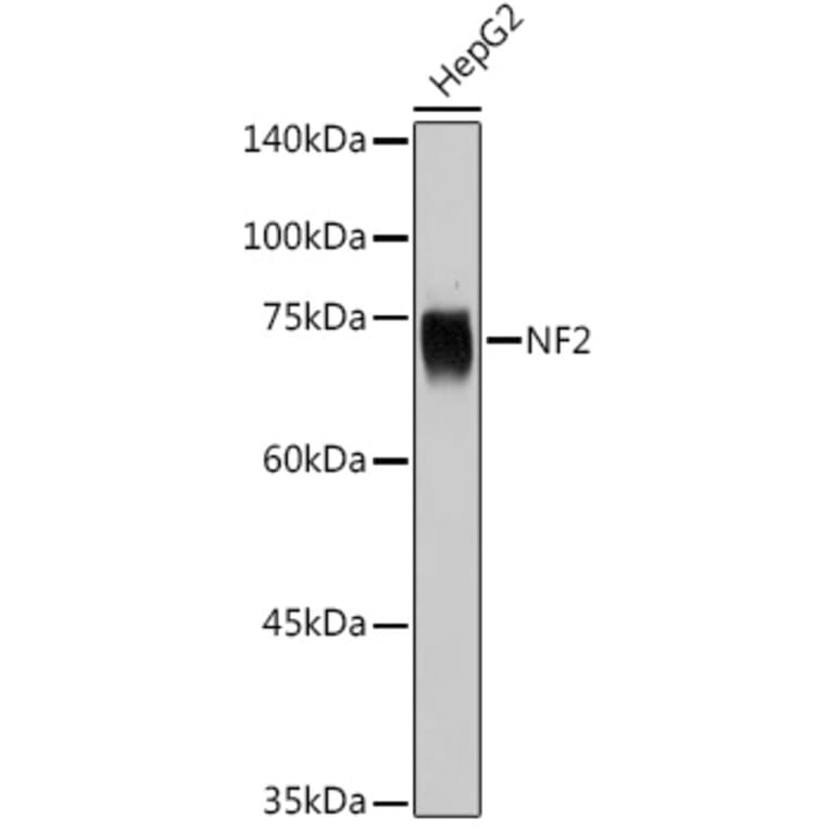 Western Blot - Anti-NF2 / Merlin Antibody (A91286) - Antibodies.com