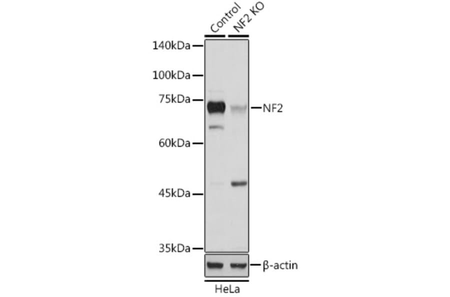 Western Blot - Anti-NF2 / Merlin Antibody (A91286) - Antibodies.com