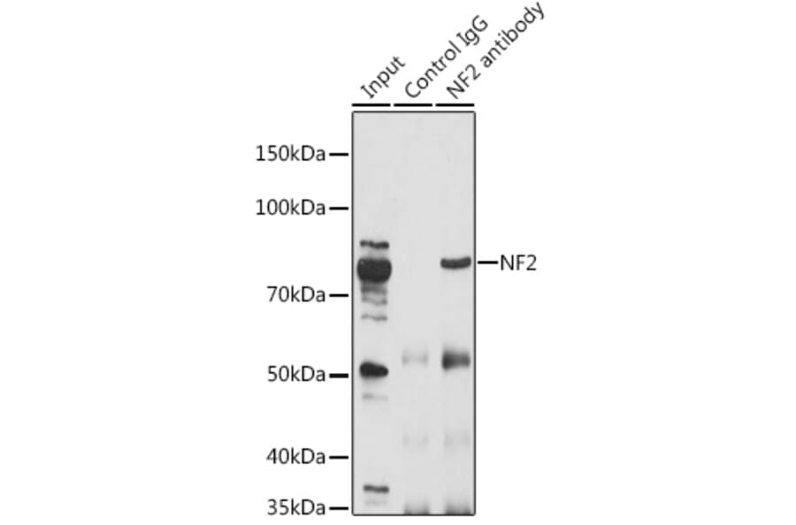 Western Blot - Anti-NF2 / Merlin Antibody (A91286) - Antibodies.com