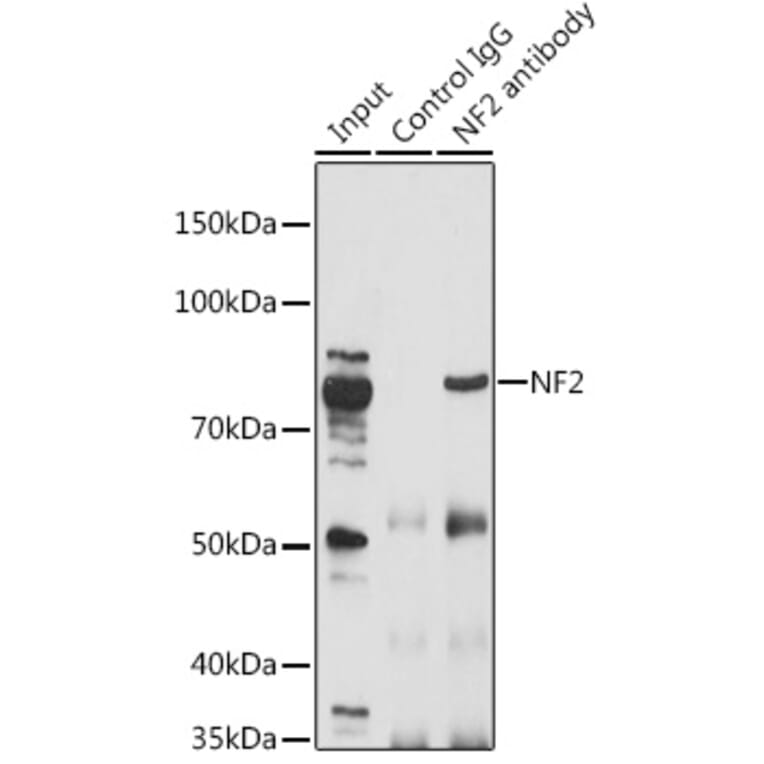 Western Blot - Anti-NF2 / Merlin Antibody (A91286) - Antibodies.com