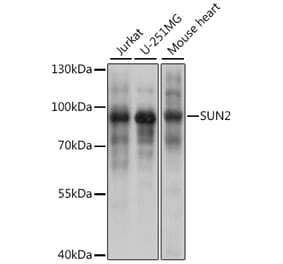 Western Blot - Anti-SUN2 Antibody (A91287) - Antibodies.com