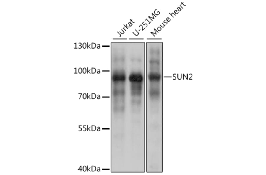 Western Blot - Anti-SUN2 Antibody (A91287) - Antibodies.com