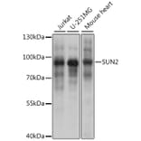 Western Blot - Anti-SUN2 Antibody (A91287) - Antibodies.com
