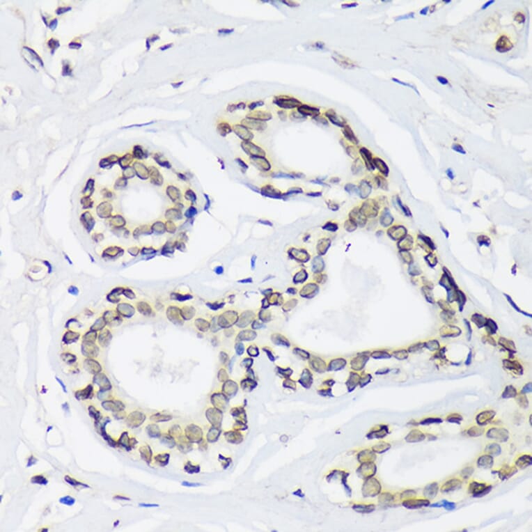 Immunohistochemistry - Anti-SUN2 Antibody (A91287) - Antibodies.com