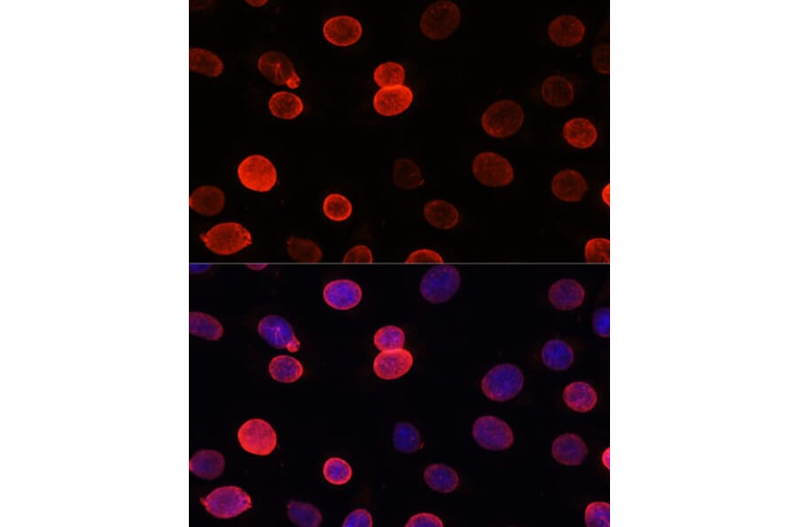 Immunofluorescence - Anti-SUN2 Antibody (A91287) - Antibodies.com
