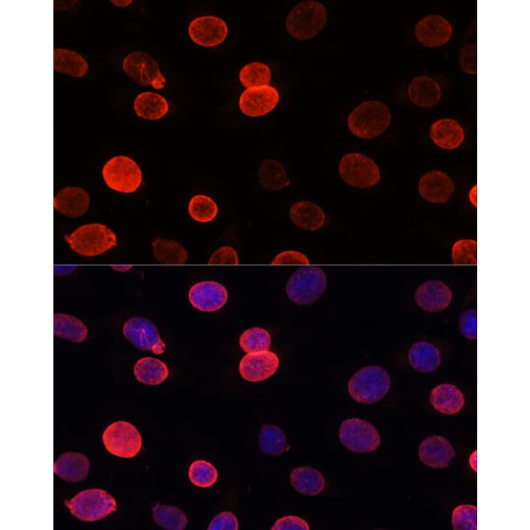 Immunofluorescence - Anti-SUN2 Antibody (A91287) - Antibodies.com