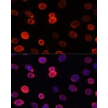 Immunofluorescence - Anti-SUN2 Antibody (A91287) - Antibodies.com
