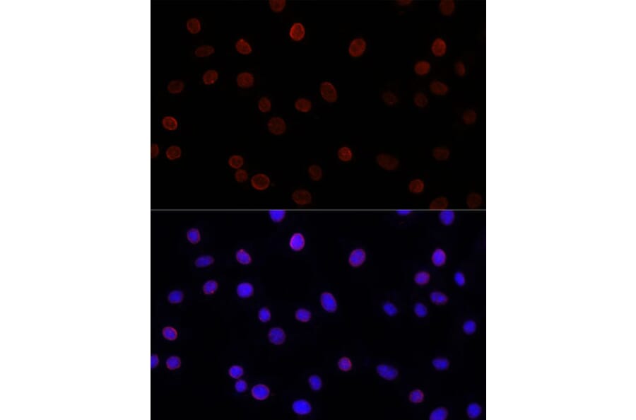 Immunofluorescence - Anti-SUN2 Antibody (A91287) - Antibodies.com