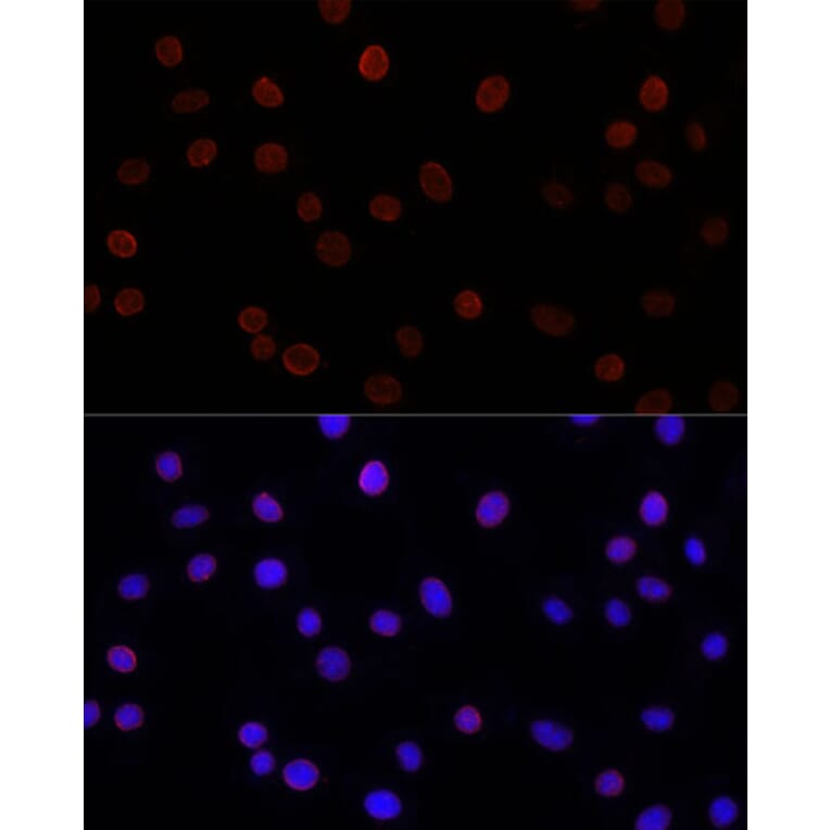Immunofluorescence - Anti-SUN2 Antibody (A91287) - Antibodies.com