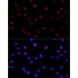 Immunofluorescence - Anti-SUN2 Antibody (A91287) - Antibodies.com