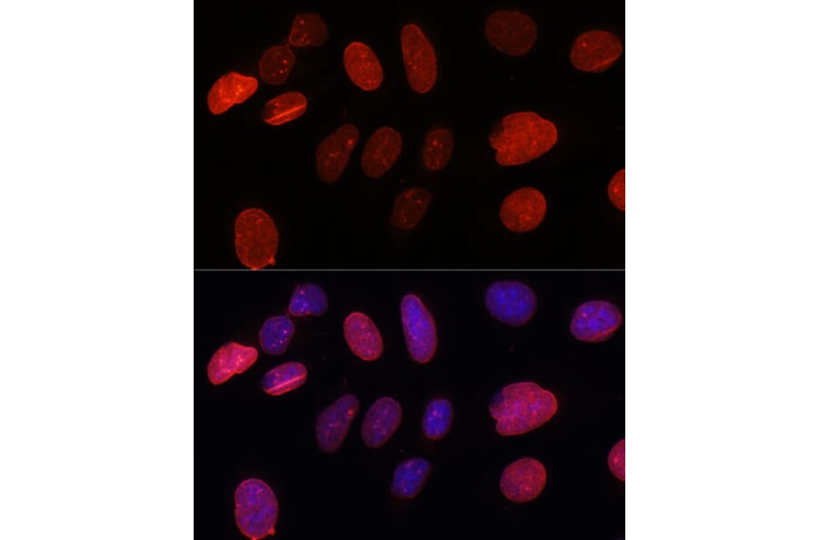 Immunofluorescence - Anti-SUN2 Antibody (A91287) - Antibodies.com