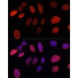 Immunofluorescence - Anti-SUN2 Antibody (A91287) - Antibodies.com