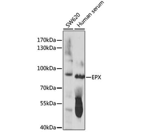 Western Blot - Anti-EPX Antibody (A91288) - Antibodies.com