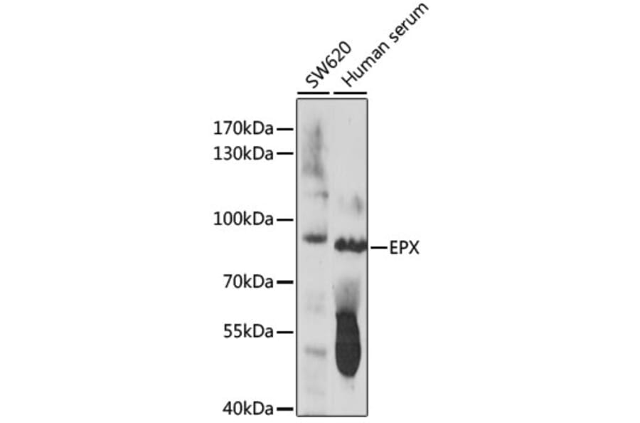 Western Blot - Anti-EPX Antibody (A91288) - Antibodies.com