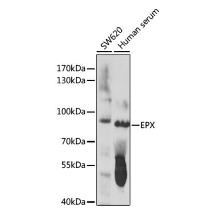Western Blot - Anti-EPX Antibody (A91288) - Antibodies.com