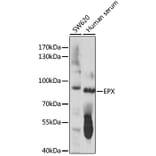 Western Blot - Anti-EPX Antibody (A91288) - Antibodies.com