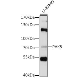 Western Blot - Anti-PAK5 Antibody (A91289) - Antibodies.com