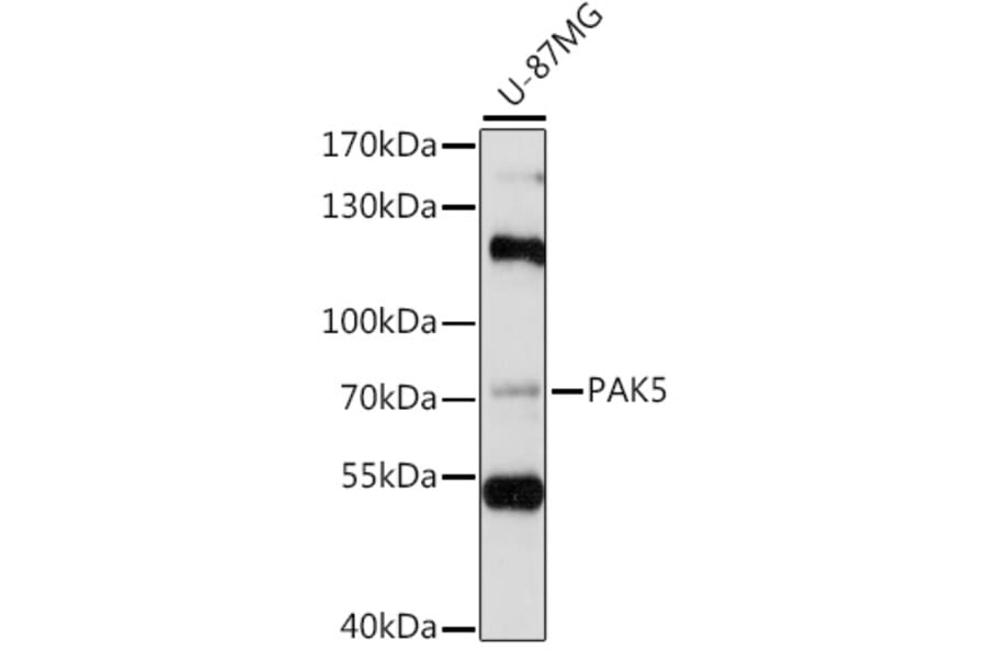 Western Blot - Anti-PAK5 Antibody (A91289) - Antibodies.com