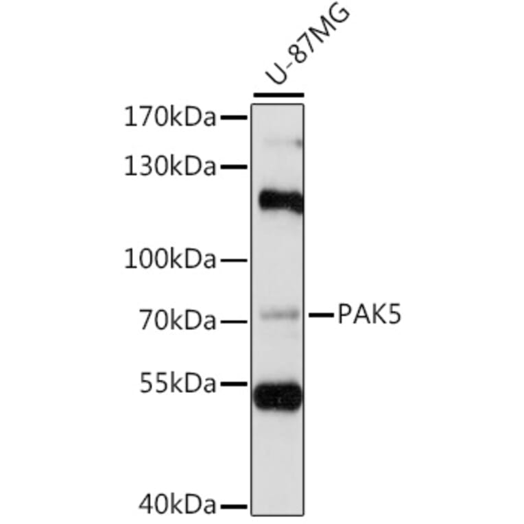 Western Blot - Anti-PAK5 Antibody (A91289) - Antibodies.com