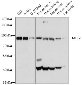 Western blot analysis of extracts of various cell lines, using Anti-MTIF2 Antibody (A16402) at 1:1,000 dilution.
Secondary antibody: Goat Anti-Rabbit IgG (H+L) (HRP) (AS014) at 1:10,000 dilution.
Lysates / proteins: 25µg per lane.
Blocking buffer: 3% non-fat dry milk in TBST.
Detection: ECL Basic Kit (RM00020).
Exposure time: 5s.