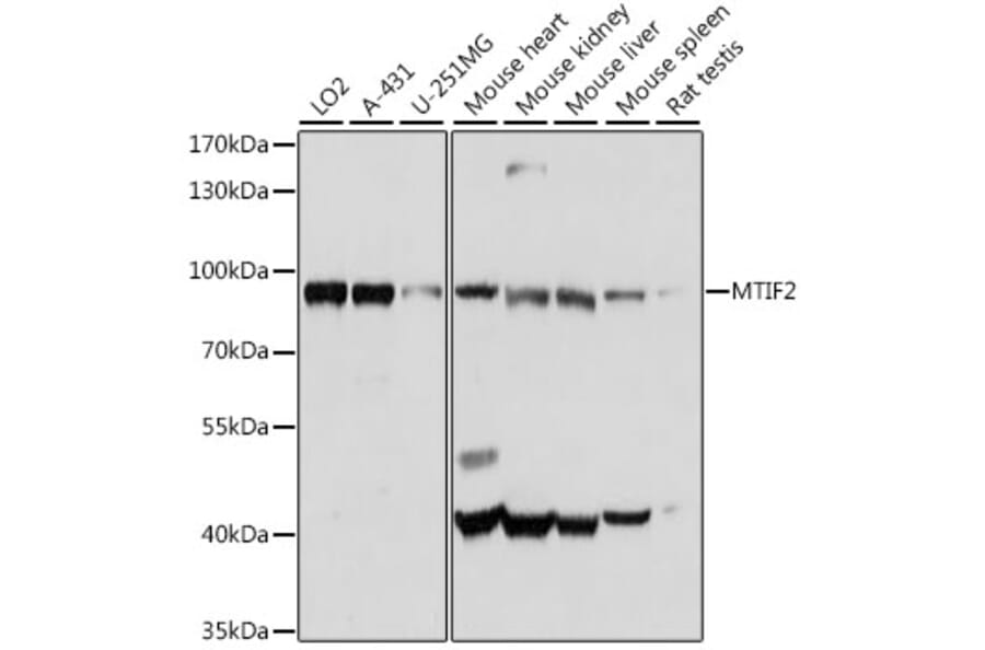 Western Blot - Anti-MTIF2 Antibody (A91290) - Antibodies.com