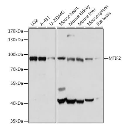 Western Blot - Anti-MTIF2 Antibody (A91290) - Antibodies.com