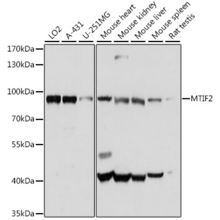 Western Blot - Anti-MTIF2 Antibody (A91290) - Antibodies.com