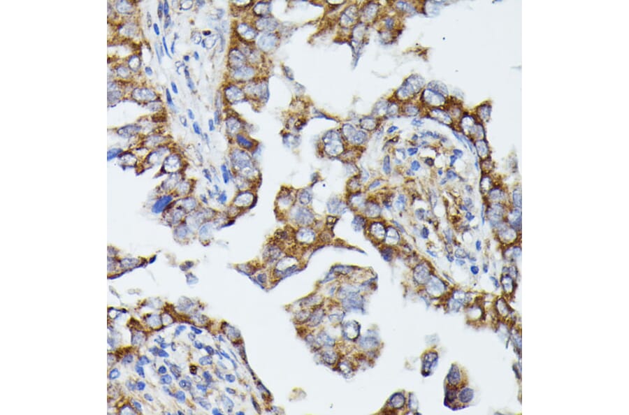 Immunohistochemistry - Anti-MTIF2 Antibody (A91290) - Antibodies.com