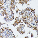 Immunohistochemistry - Anti-MTIF2 Antibody (A91290) - Antibodies.com