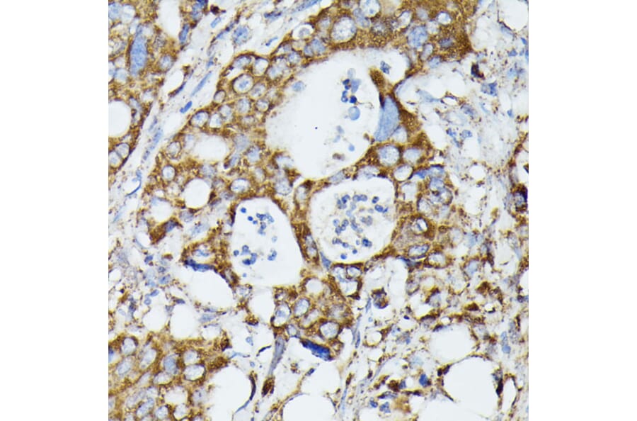 Immunohistochemistry - Anti-MTIF2 Antibody (A91290) - Antibodies.com