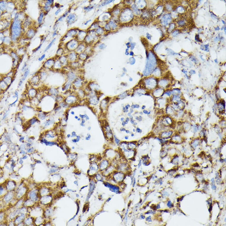 Immunohistochemistry - Anti-MTIF2 Antibody (A91290) - Antibodies.com