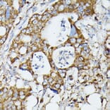 Immunohistochemistry - Anti-MTIF2 Antibody (A91290) - Antibodies.com