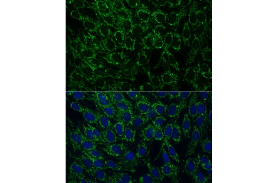 Immunofluorescence - Anti-MTIF2 Antibody (A91290) - Antibodies.com