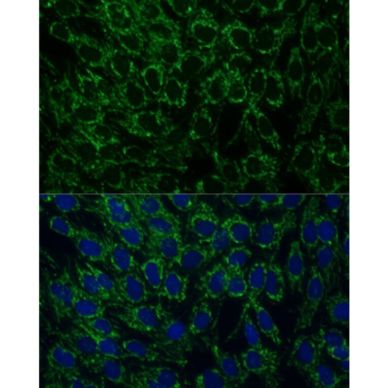 Immunofluorescence - Anti-MTIF2 Antibody (A91290) - Antibodies.com