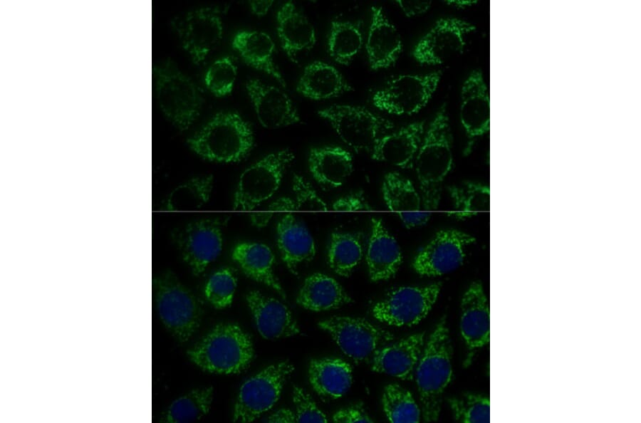 Immunofluorescence - Anti-MTIF2 Antibody (A91290) - Antibodies.com