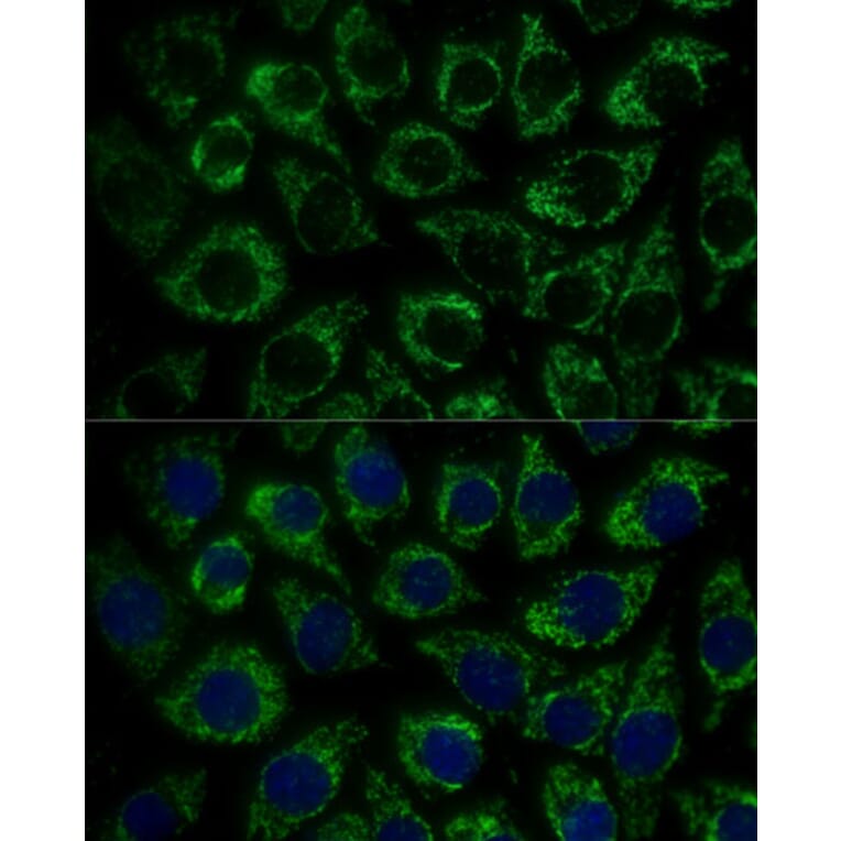 Immunofluorescence - Anti-MTIF2 Antibody (A91290) - Antibodies.com