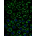 Immunofluorescence - Anti-MTIF2 Antibody (A91290) - Antibodies.com