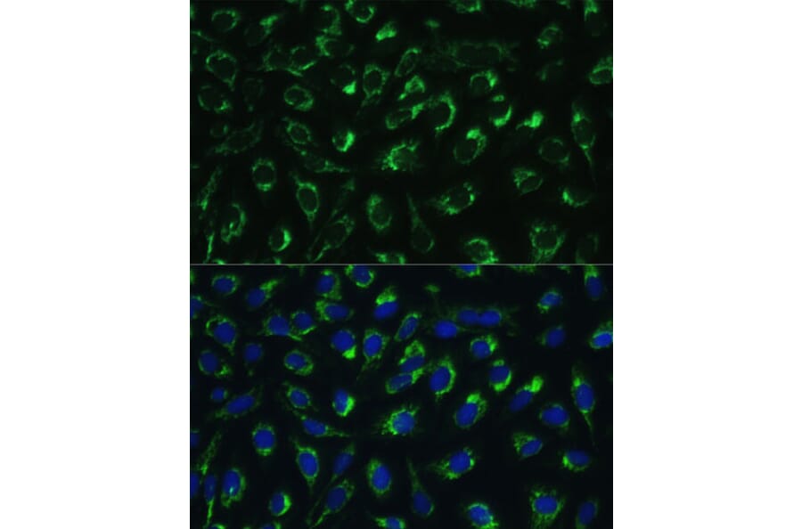 Immunofluorescence - Anti-MTIF2 Antibody (A91290) - Antibodies.com