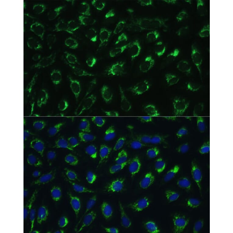 Immunofluorescence - Anti-MTIF2 Antibody (A91290) - Antibodies.com