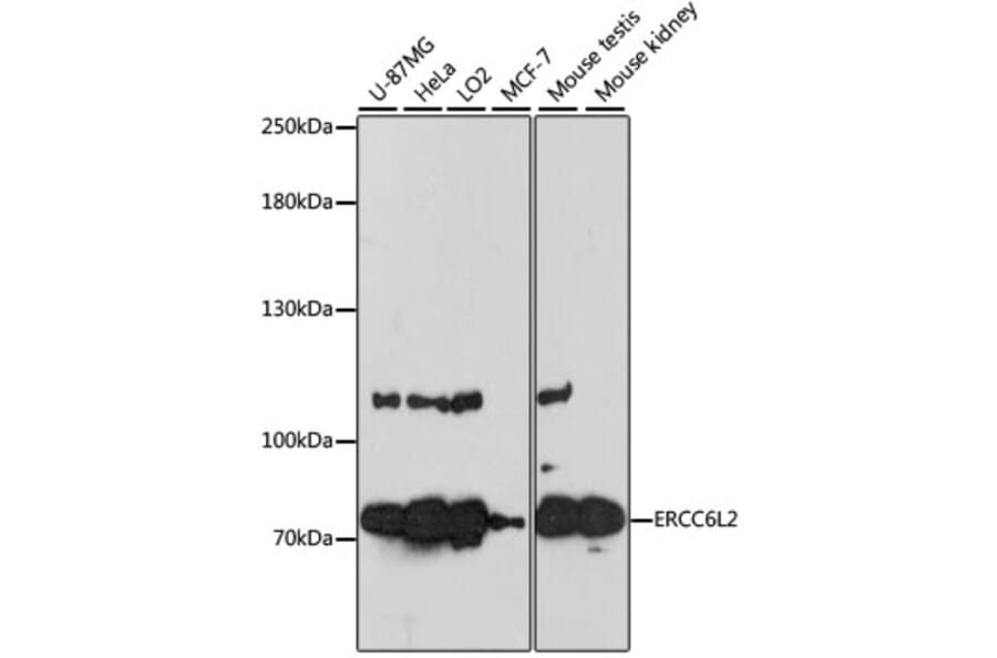 Western Blot - Anti-ERCC6L2 Antibody (A91292) - Antibodies.com