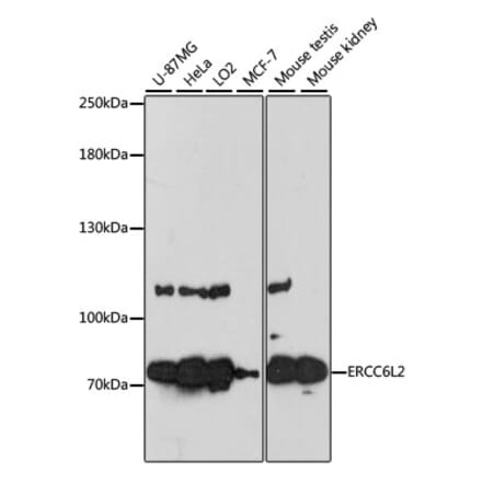 Western Blot - Anti-ERCC6L2 Antibody (A91292) - Antibodies.com