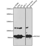 Western Blot - Anti-ERCC6L2 Antibody (A91292) - Antibodies.com