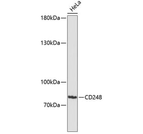 Western Blot - Anti-TEM1 Antibody (A91293) - Antibodies.com