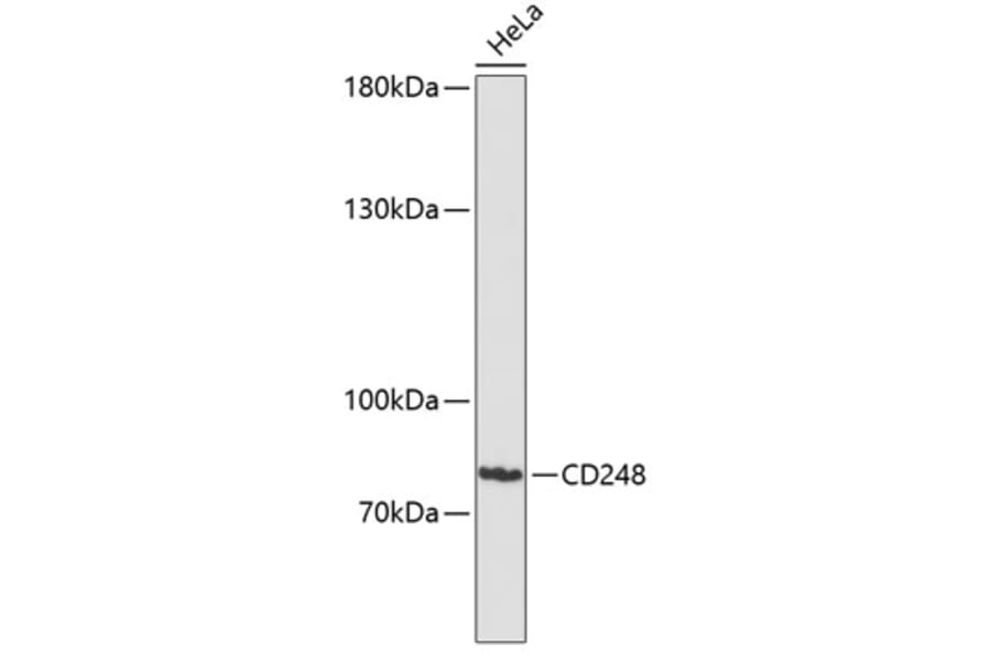Western Blot - Anti-TEM1 Antibody (A91293) - Antibodies.com
