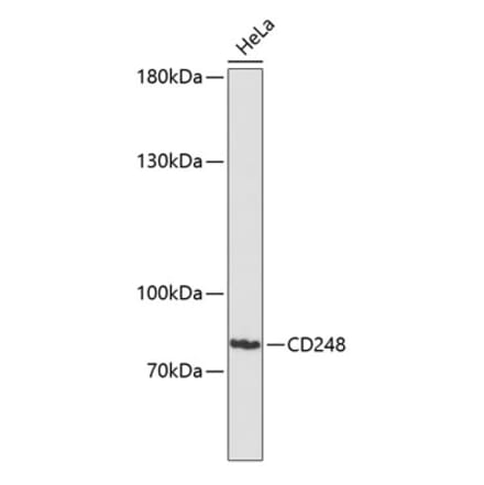 Western Blot - Anti-TEM1 Antibody (A91293) - Antibodies.com