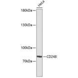 Western Blot - Anti-TEM1 Antibody (A91293) - Antibodies.com