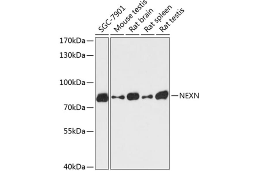 Western Blot - Anti-Nexilin/F-actin-binding protein Antibody (A91295) - Antibodies.com