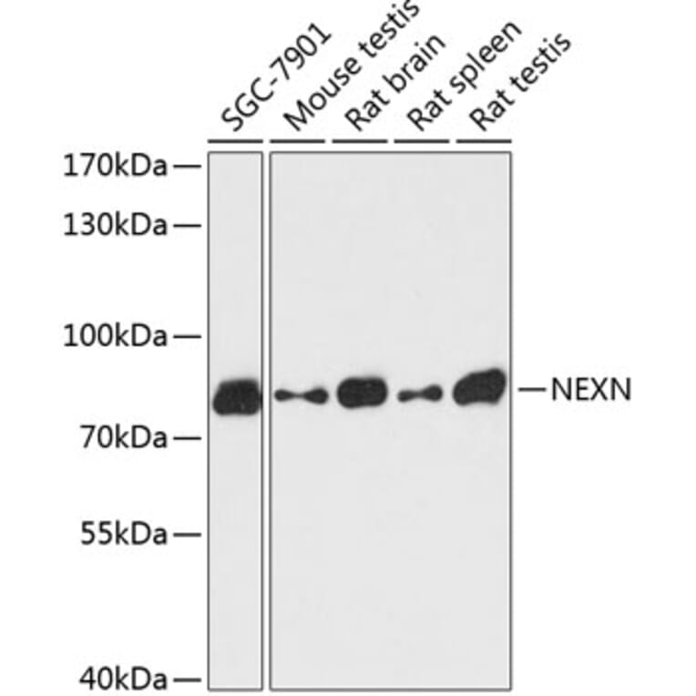 Western Blot - Anti-Nexilin/F-actin-binding protein Antibody (A91295) - Antibodies.com